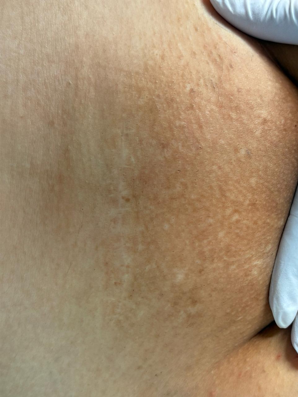 Imagem do Resultado 4